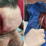 Briga por água entre irmãos termina em agressão grave na zona rural de Formosa